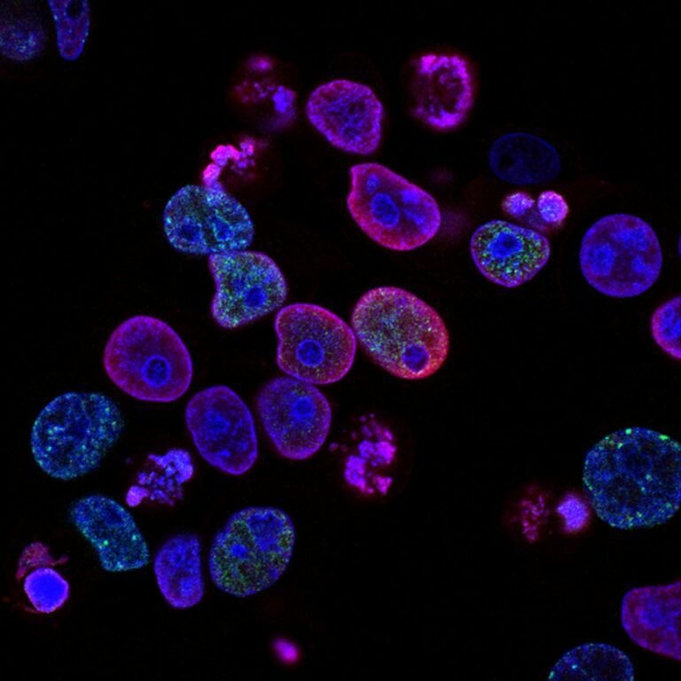 Liver Health in Bangladesh: The NAFLD Epidemic and How to Protect Your Liver